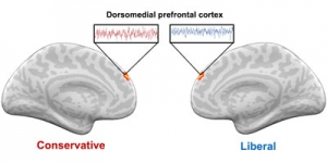 Conservative and liberal brains respond differently to hot-button vocabulary.